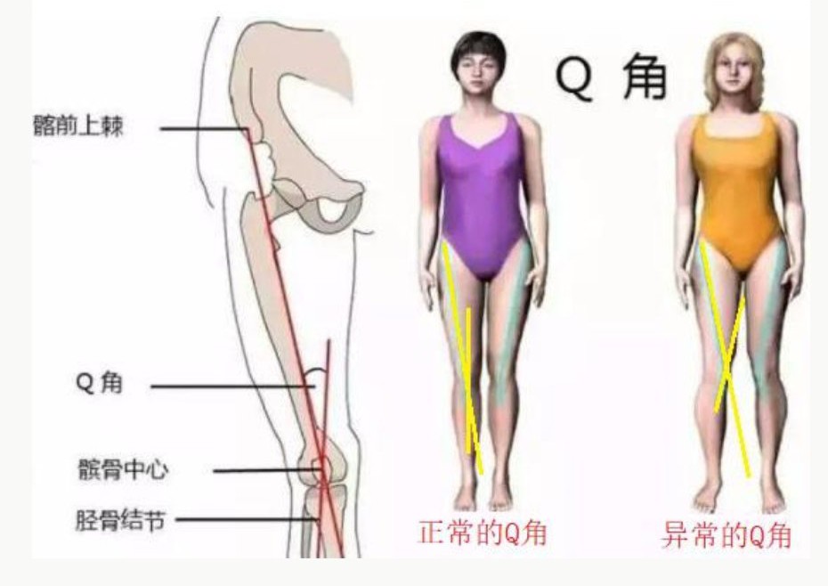 教你练成完美身材(6)——如何矫正O型腿