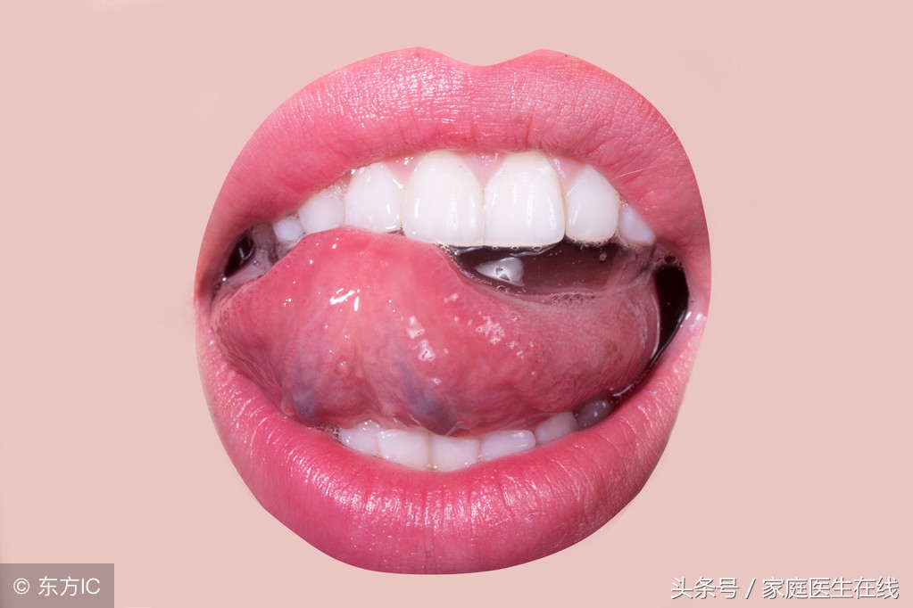 舌头起泡难受？坚持这5个方法，能缓解痛苦！