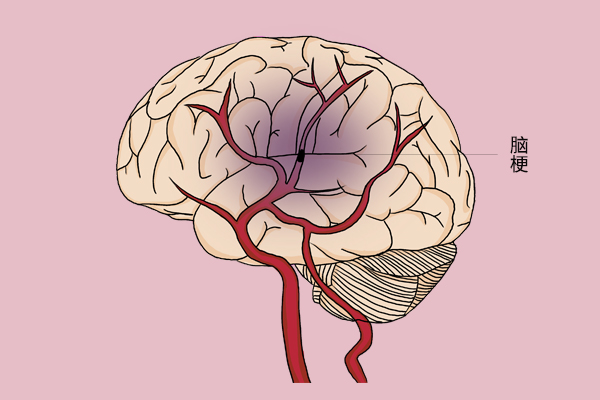 脑血管图片卡通图片