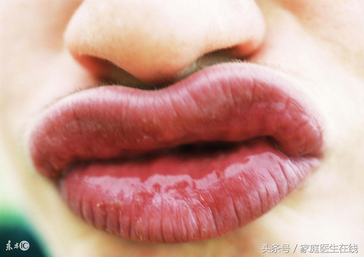 嘴巴告诉你的6个密码：医生教你从嘴巴看疾病，从嘴唇看健康！_6.流口水