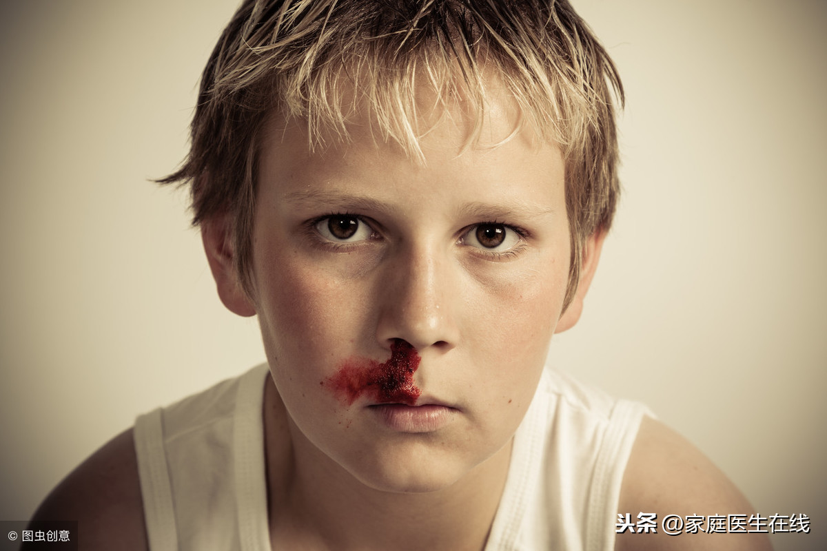 儿童经常性流鼻血，家长还是要提高警惕！两个原因要深究