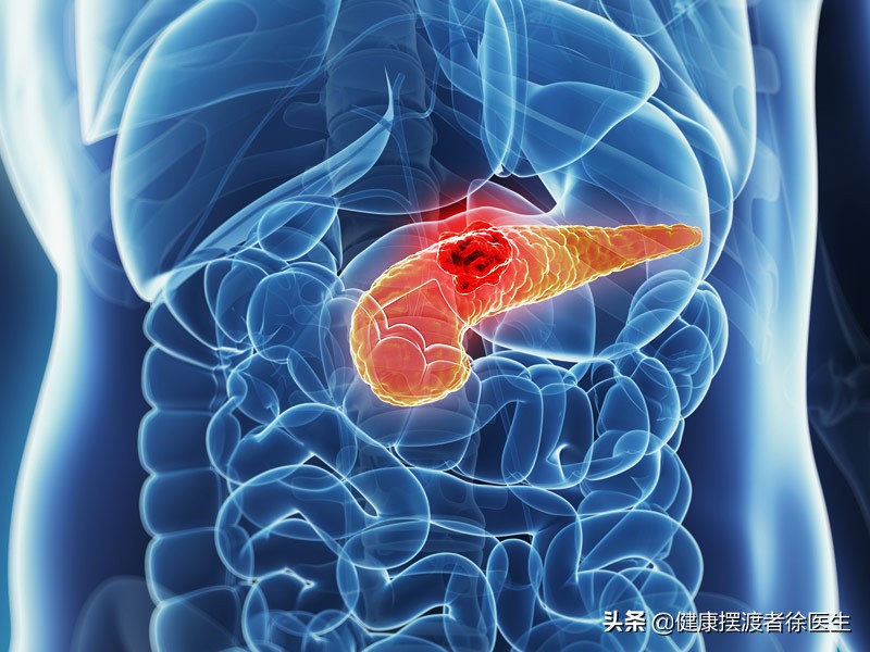 胰腺是什么？为何胰腺癌很可怕？
