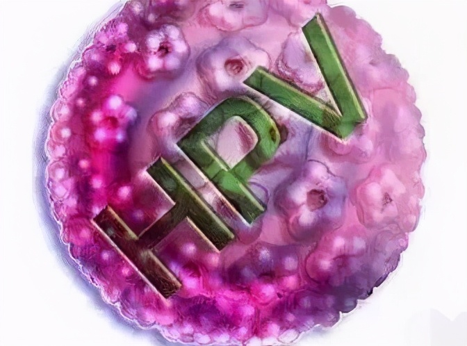 HPV是怎么感染上的(HPV病毒感染的原因都有哪些)