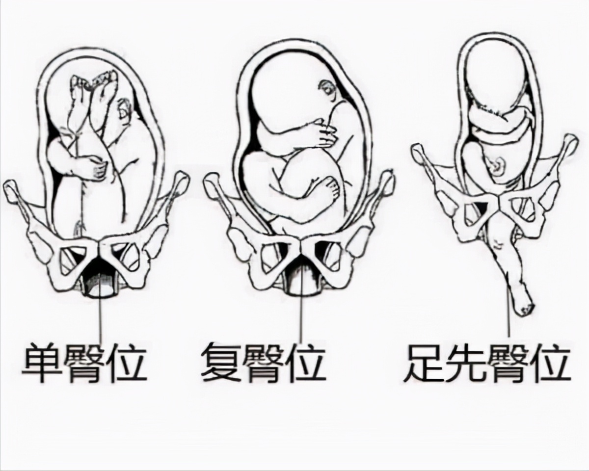 婴儿后囟门位置图（关于宝宝囟门的几个冷知识）-幼儿百科-魔术铺