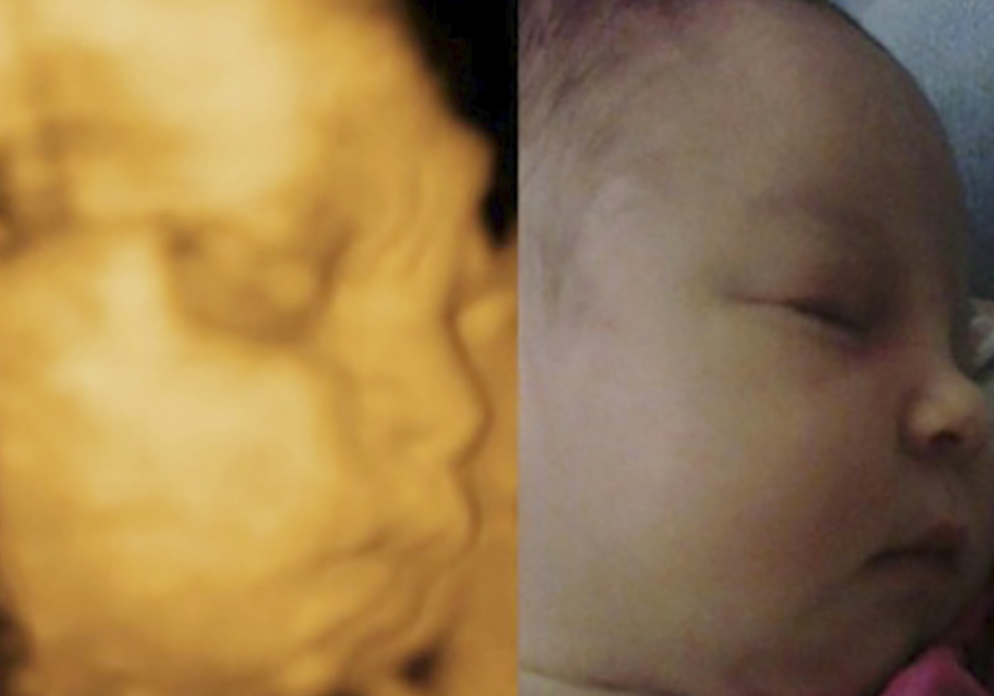 “四维彩超”直击：子宫里双胞胎宝宝的日常互动