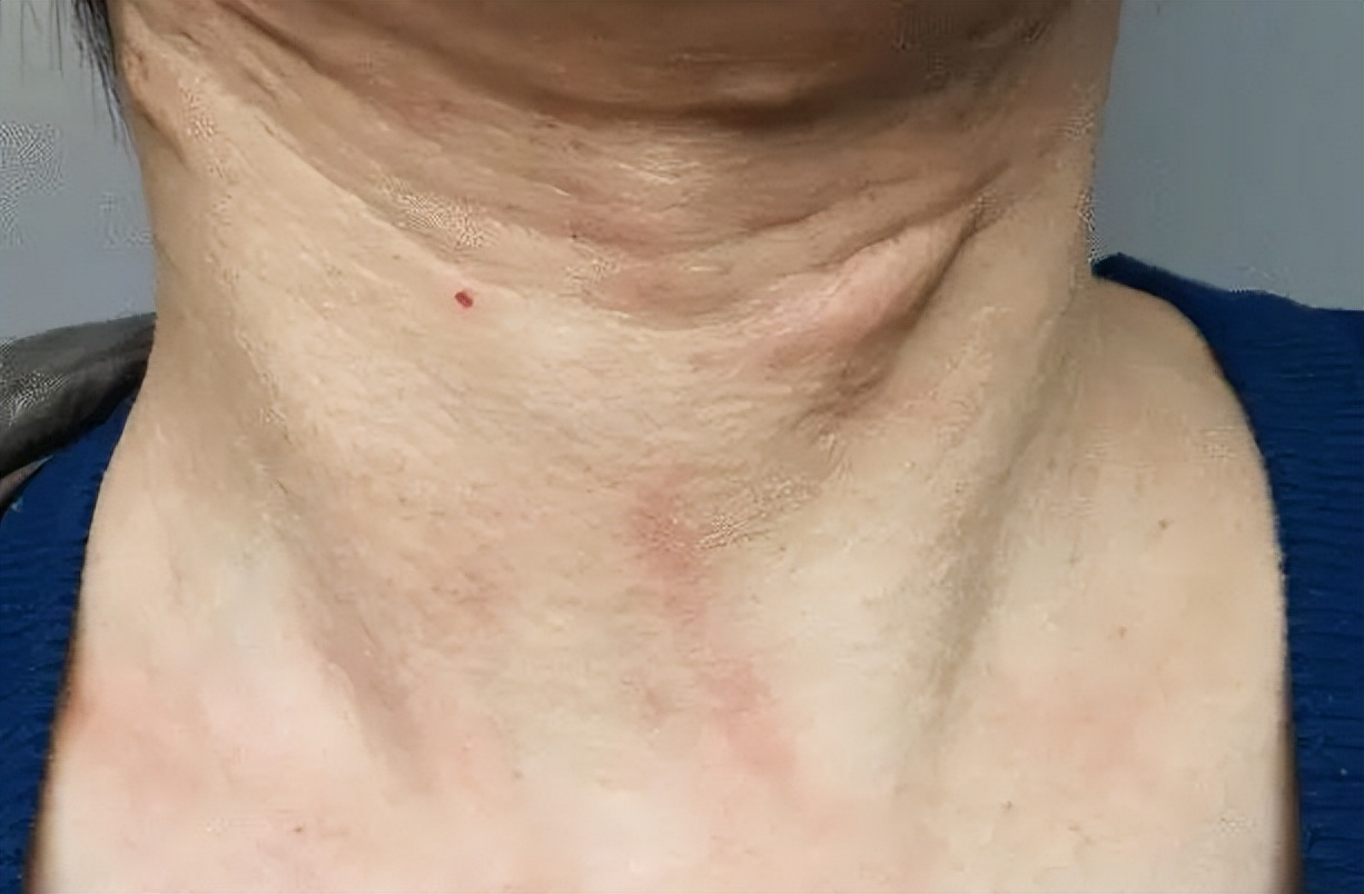 颈部淋巴结分区示意图-图库-五毛网
