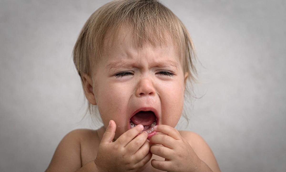 烂嘴角怎么最快治疗（孩子烂嘴角别乱涂药，尤其是这3种情况，医生建议这样做）