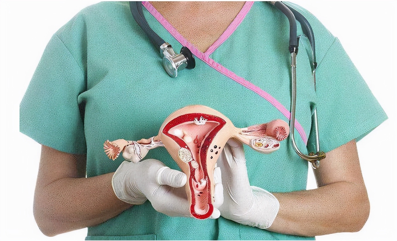 三维阴超诊断：绝经后如此幸运的大息肉|子宫内膜息肉|子宫内膜癌|雌激素|绝经|月经|阴道|-健康界