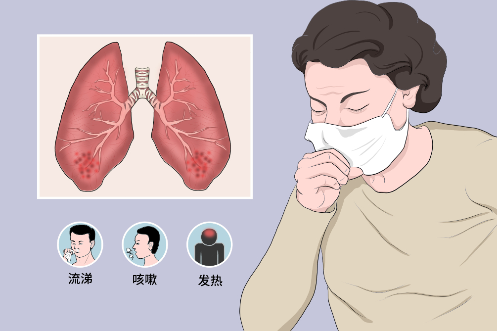 怎么治支气管炎咳嗽（支气管炎干咳，坚持这么做，支气管炎好转得很快）