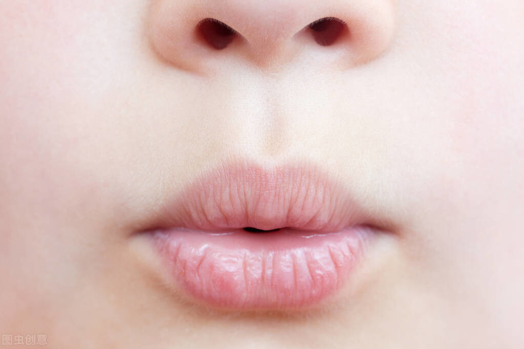 唇炎怎么治疗最有效（治疗唇炎，有效的措施有哪些，要注意什么？）-第3张图片-冰筹网