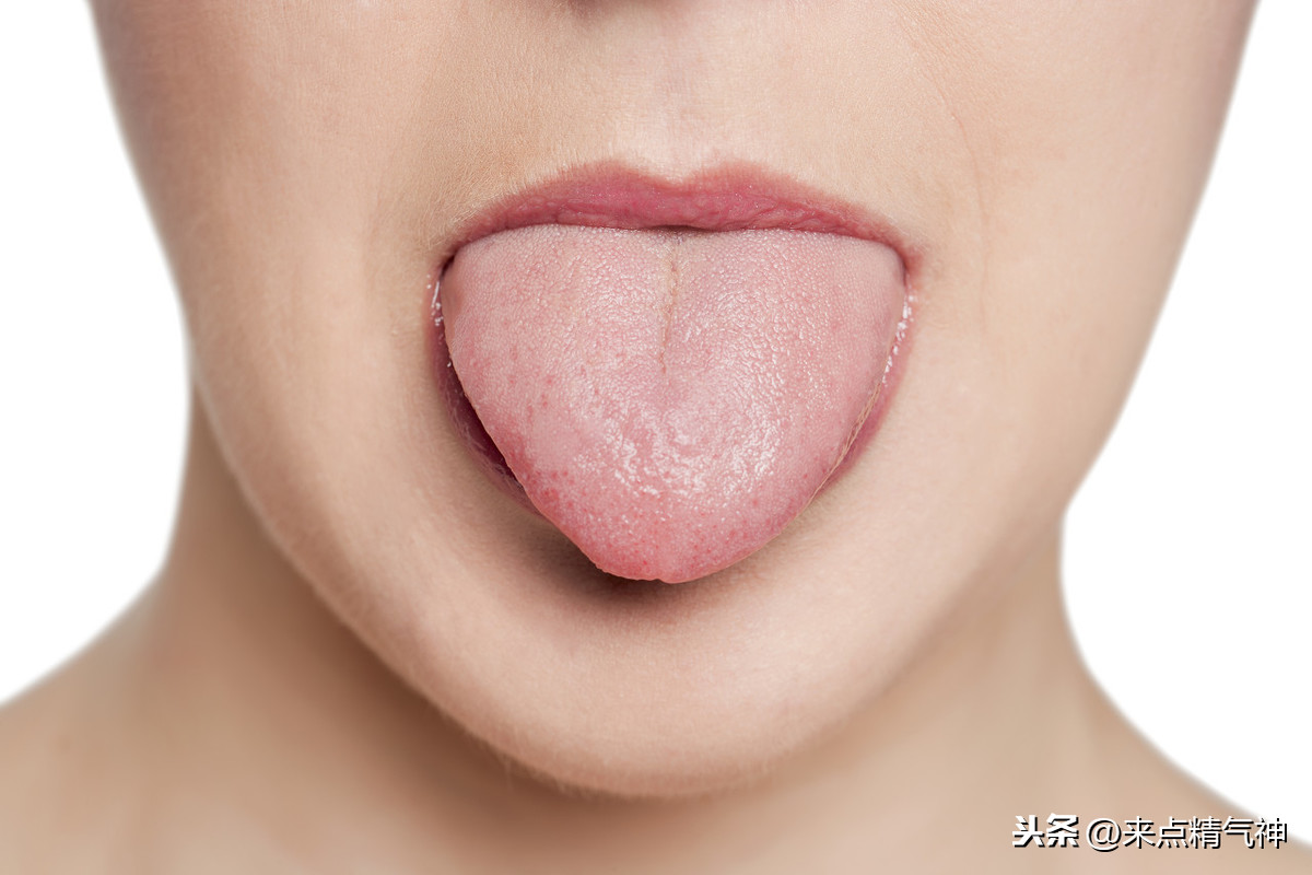 舌头白是怎么回事（“舌苔厚”是病吗？舌头白腻说明了什么？听听医生怎么认为的）