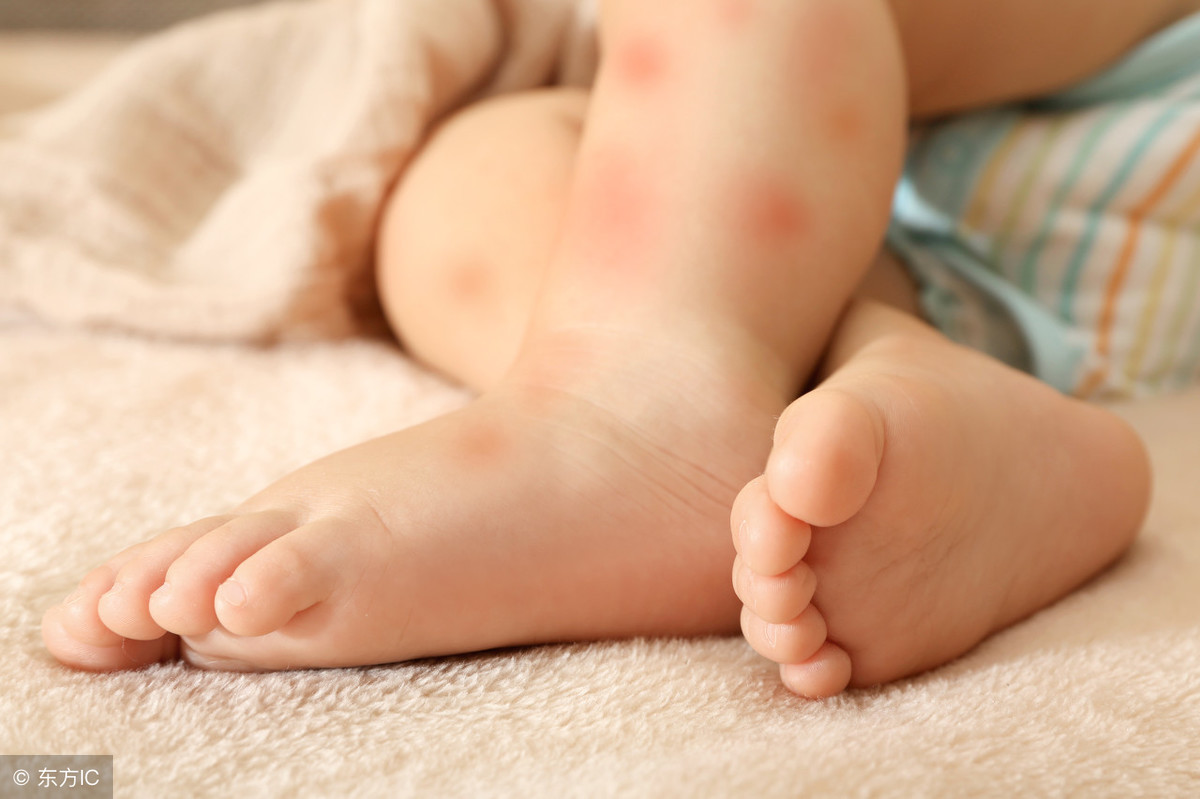 湿疹干燥脱皮代表什么（宝宝湿疹痊愈后，皮肤干燥掉皮怎么办？这5个小要点需谨记）