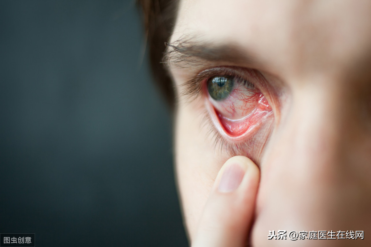 眼睛有红血丝怎么回事（眼睛出现红血丝，或是疾病发射出来的信号！警惕5种情况）