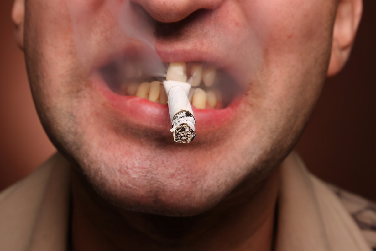 吸烟会对牙齿带来哪些危害？_深圳爱康健口腔医院官网
