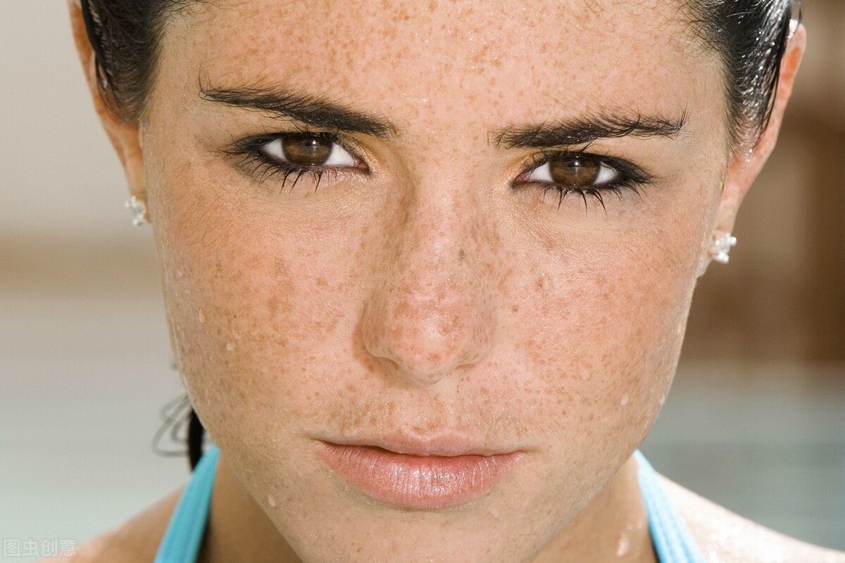 脸上长斑点怎么办最快最有效（被脸上的斑所困扰，应该如何安全有效的去除？祛斑小方法分享给你）