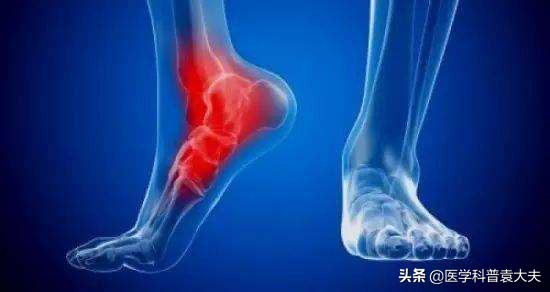 脚后跟痛是什么原因及治疗方法（脚后跟疼痛多半与这两种疾病有关，医生教你如何有效治疗）