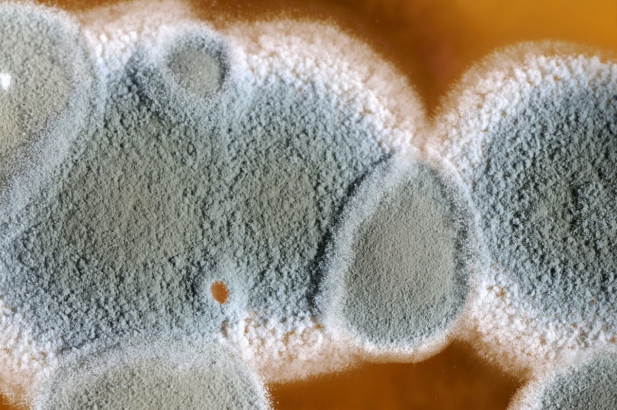 白带常规(二)有真菌和滴虫的白带常规，40倍镜下形态 - 知乎