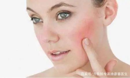 脸痒是怎么回事怎样治疗（面部皮肤有反复瘙痒，可能的情况都有哪些？）